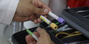 El tipo de alimentación es determinante en la aparición de cálculos renales: especialistas en medicina y nutrición